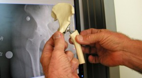 Bare Bones Expenses for Orthopedic Surgeons: 3-D bone printing at 10% cost of traditional bone models
