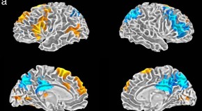 Mic Check! Brain Scans of Freestyle Rappers Reveal Creativity Regions